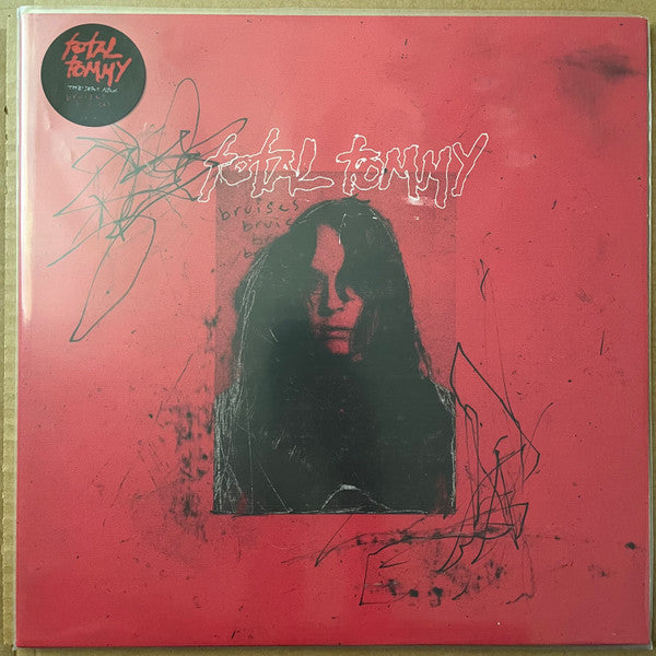 TOTAL TOMMY - BRUISES